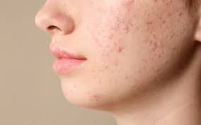 A pele , estando em contato com o exterior, protegendo permanentemente o organismo, está continuamente sujeita a agressões que modificam sua aparência